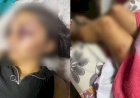 Adolescente é sequestrada e tem rosto desfigurado após agressões de namorado no Ceará