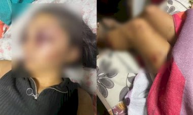 Adolescente é sequestrada e tem rosto desfigurado após agressões de namorado no Ceará